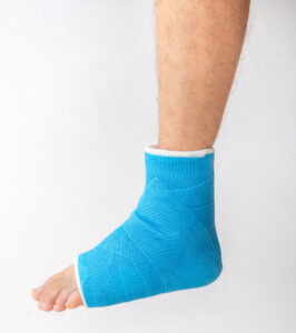Foot and ankle in plaster following a fracture